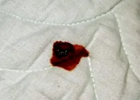 saltelei