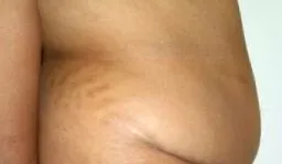 előtt