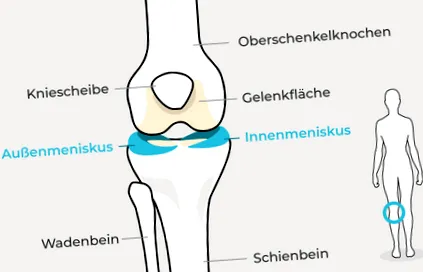 meniscului