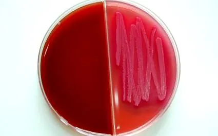 Streptococcus agalactiae