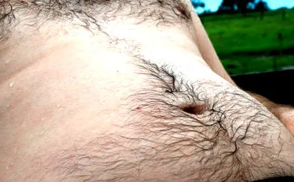 Redukáló gélek