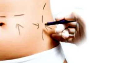 lokalizált