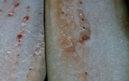 melanzane