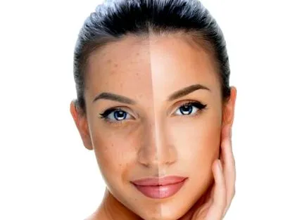 cosmetic