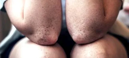 okai