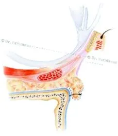 riscurile