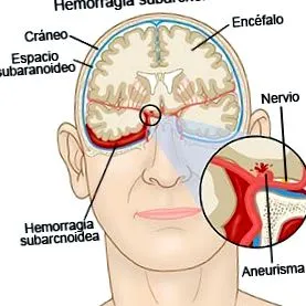 útmutató