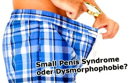 sindromul sindromul