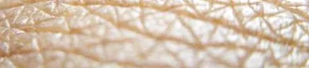 diacosa