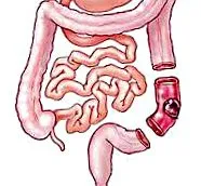 sigmoid