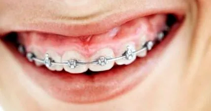 dentară