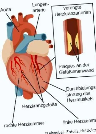 pectorală