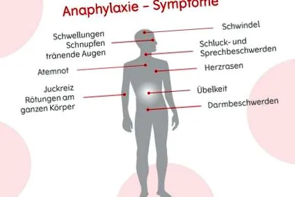 anafilactic