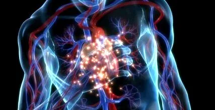 aortică