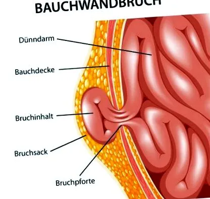 abdominal