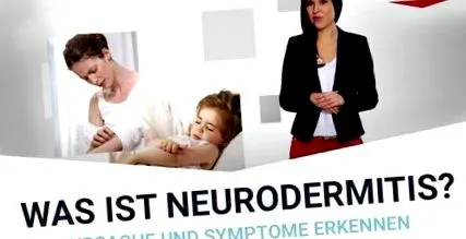 ekcéma