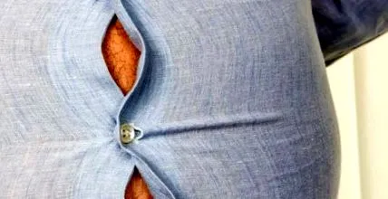 obezitatea răspândește