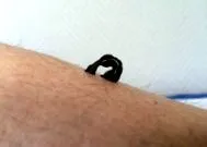terapia