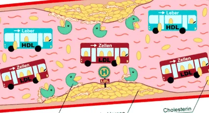 herzlexikon