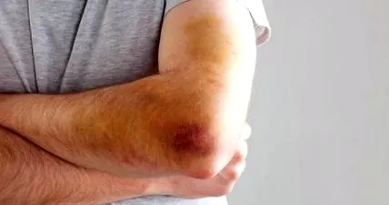 este