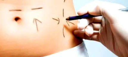 testépítés