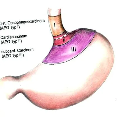 stomac