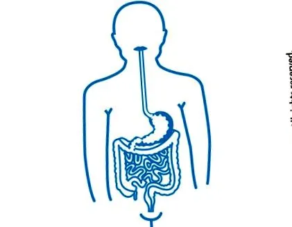cholelithiasis