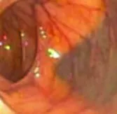 gastroenterologie portalul