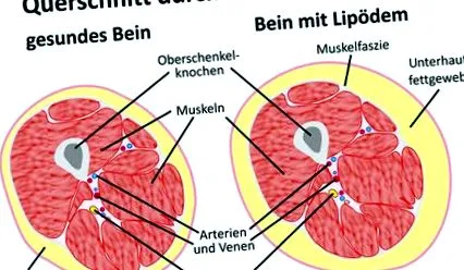 diagnostic