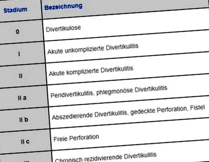 clinică diverticulită
