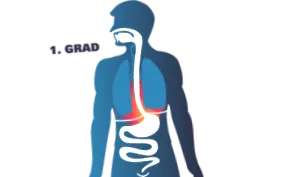 reflux