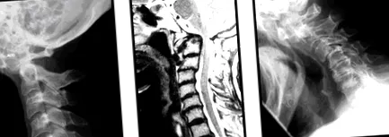 vertebrală