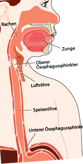 reflux
