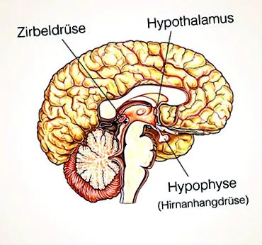 sindromul