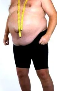 elhízás