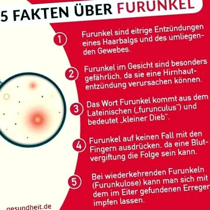 források feneket