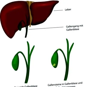 biliari
