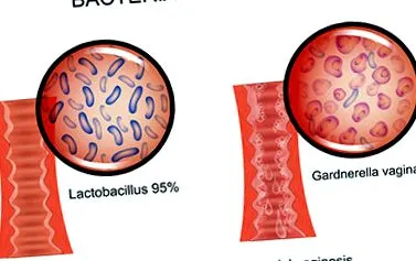 infecție infecție