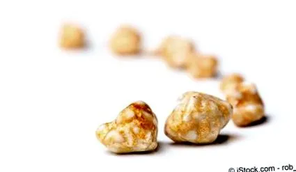 calculi