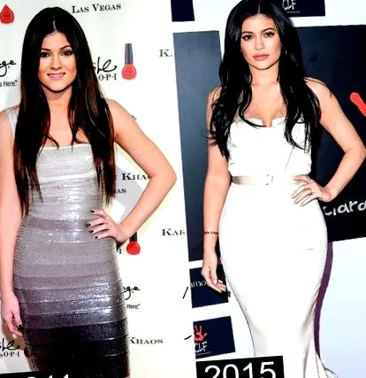 фишър