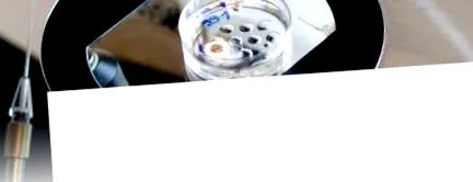 kezelés