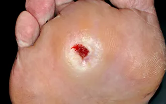 picior