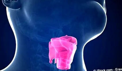laryngitis