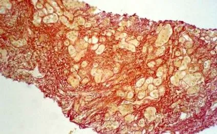 metabolismului
