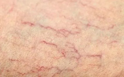 ciorapii
