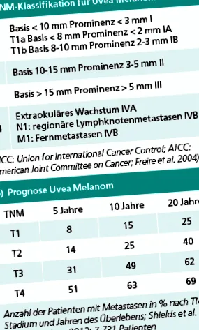 choroid melanomája
