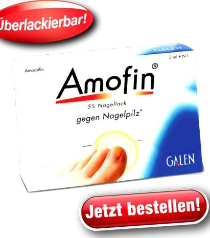 lehet megelőzni