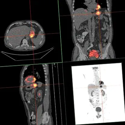gyulladása Kurkliniken üzemeltető