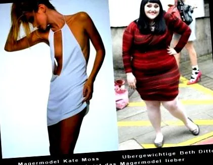 ceea anorexia