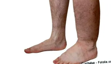 simptome